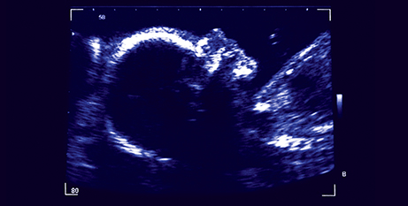 An ultrasound image of a 26-week-old unborn child (Bigstock)